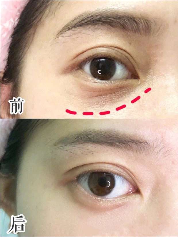 1580715072658599.jpg 1.jpg