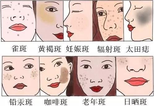 南寧美容學(xué)校：這7個(gè)日常習(xí)慣給你一臉斑