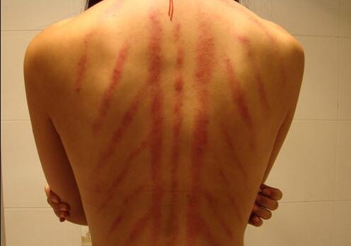 南寧美容學校：背部按摩的好處與禁忌