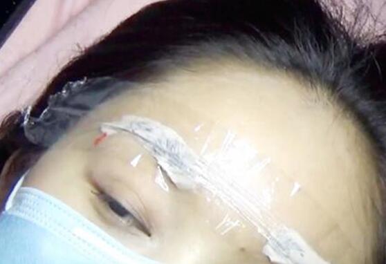 麻藥過(guò)后讓眉毛不變形的紋繡技巧