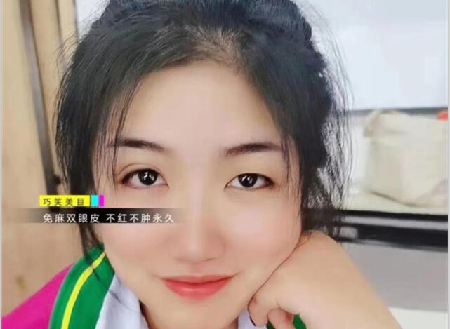 麗竹學(xué)?！凹y繡+雙眼皮”課程開講