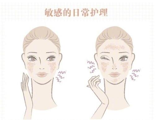 敏感肌保養(yǎng)大全！
