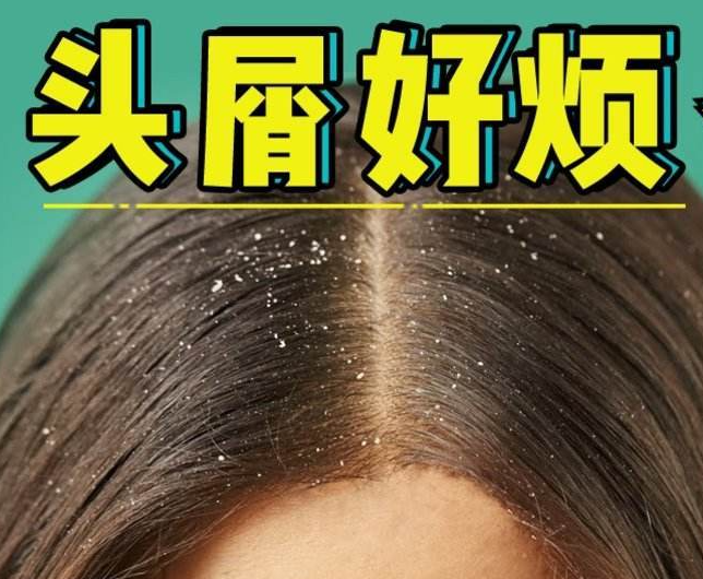 南寧正規(guī)美發(fā)培訓學校分享：冬天如何減少頭屑過多？