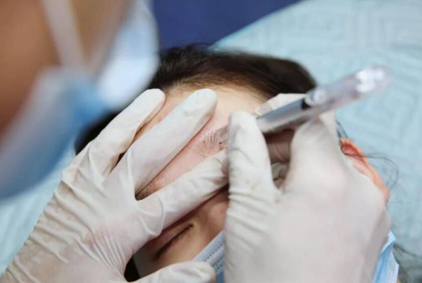 紋繡遇到容易出血的皮膚怎么辦？南寧專業(yè)紋繡培訓教你