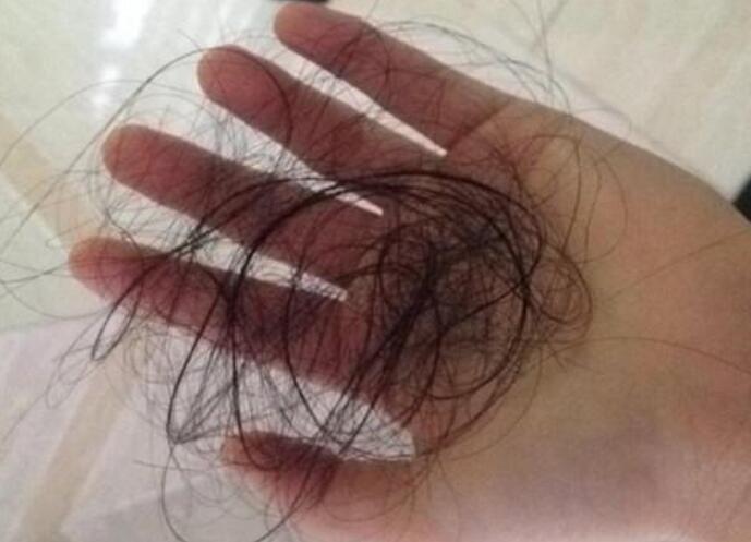 脫發(fā)女孩必備寶典！南寧美發(fā)學(xué)校教你