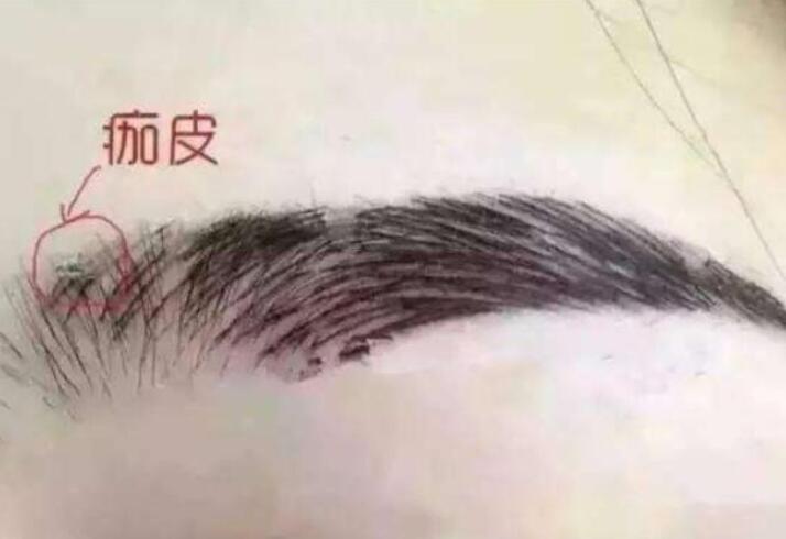 紋眉結(jié)痂時(shí)要注意什么？麗紋竹繡學(xué)校教你