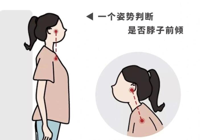 南寧學(xué)美容養(yǎng)生的學(xué)校：如何改善脖子前傾