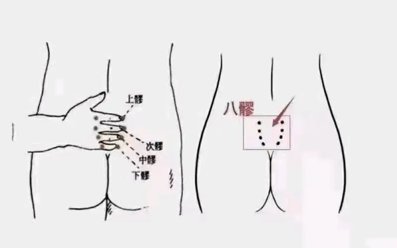 疏通八髎注意事項(xiàng)，南寧中醫(yī)美容學(xué)校培訓(xùn)內(nèi)容