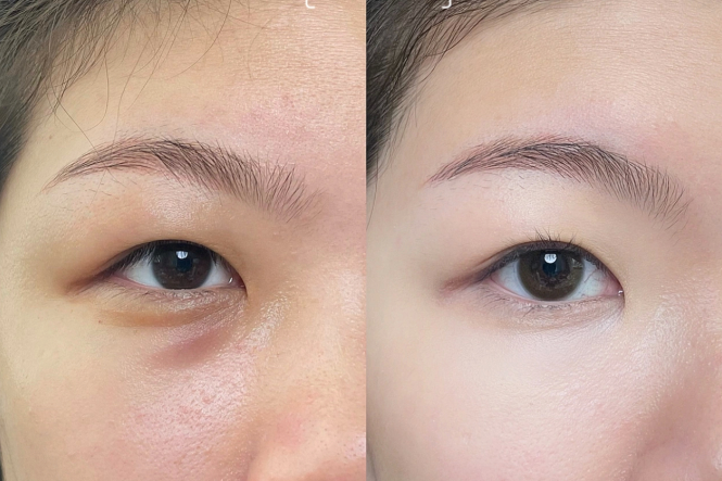 新手遮瑕教程，南寧化妝課程基礎(chǔ)分享