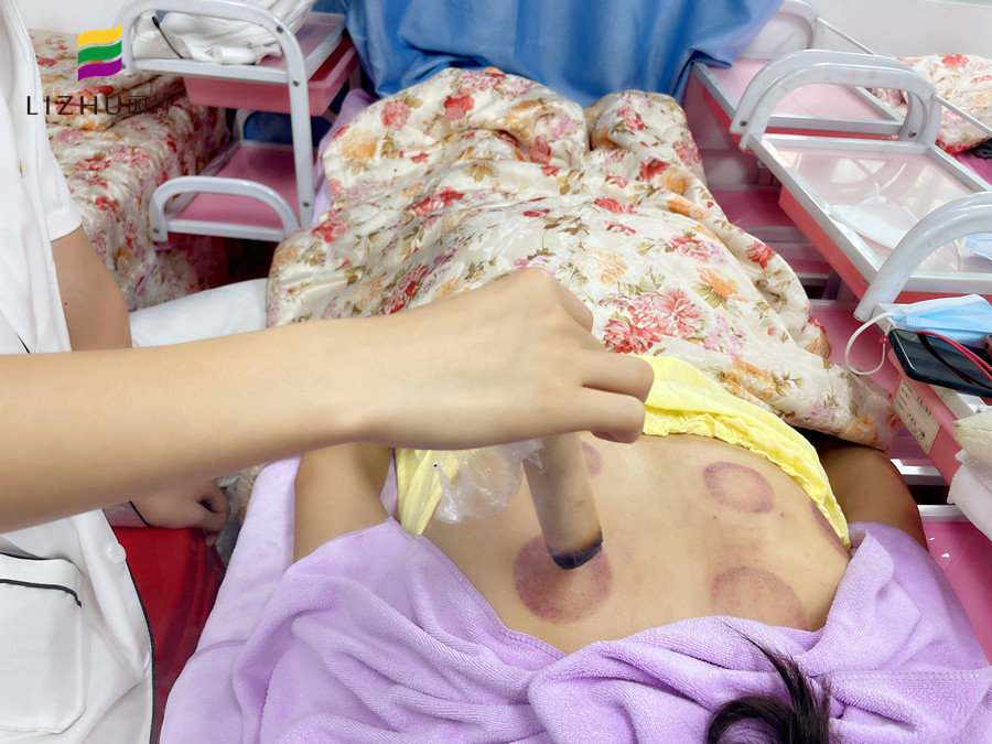 艾條艾灸注意事項(xiàng) ，廣西美容職業(yè)學(xué)校實(shí)操演示