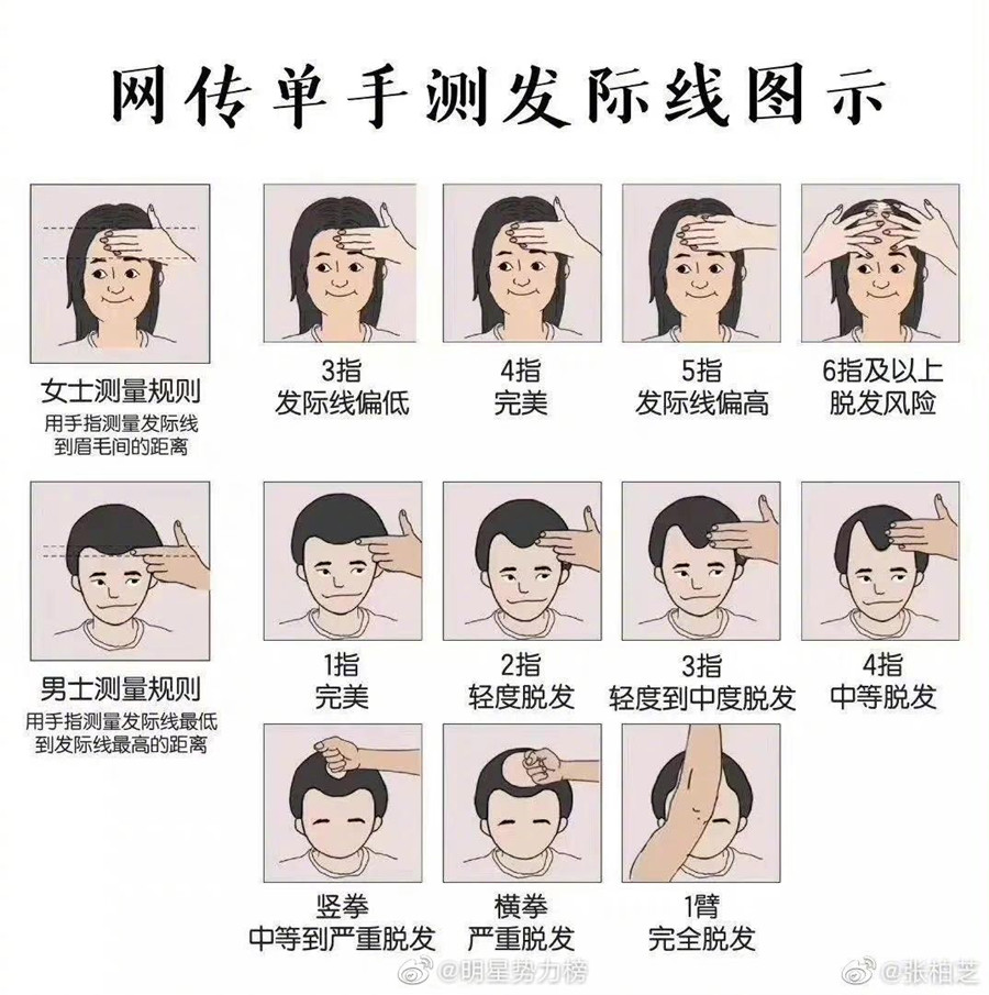 廣西頭療養(yǎng)發(fā)培訓：單手測發(fā)際線教程