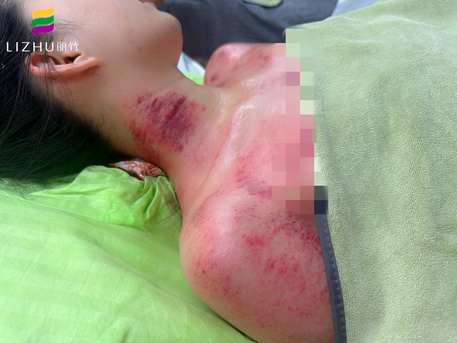 廣西學(xué)刮痧培訓(xùn)班 | 廣西學(xué)刮痧學(xué)費(fèi)多少？